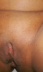 Gordinha